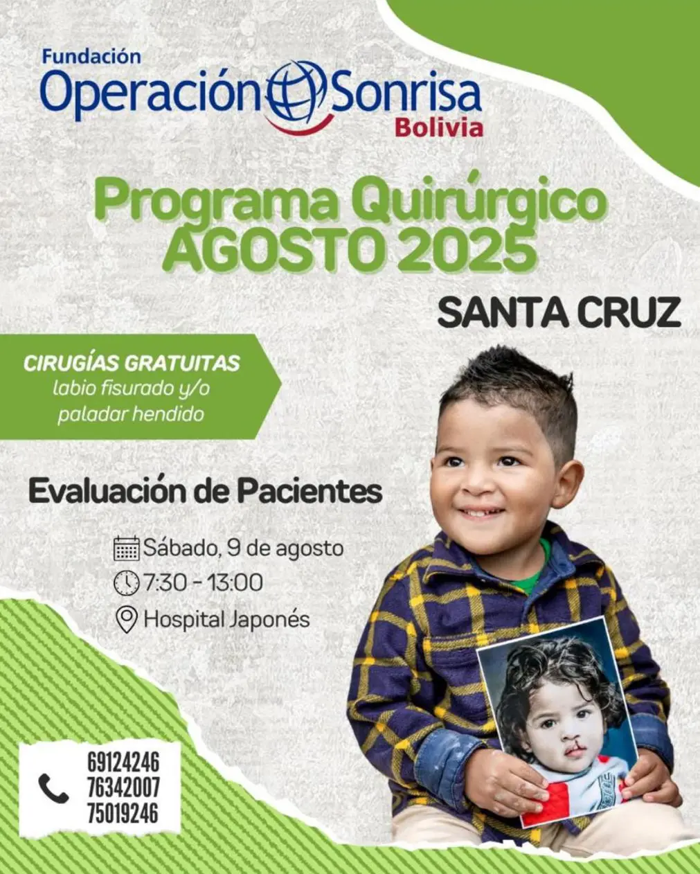 operacion-sonrisa-2025